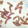 Cholera death toll rises to 75 in eastern Chad