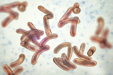 Cholera death toll rises to 75 in eastern Chad