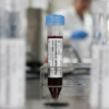 US patient with hantavirus symptoms tests negative