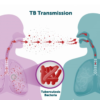 Tulsipur searching for people with tuberculosis through AI X-ray