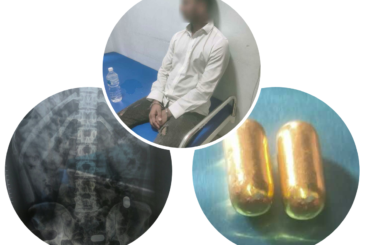 पेटभित्र सुनजस्तो धातुका क्याप्सुल लुकाएर ल्याउने बंगलादेशी नागरिक पक्राउ